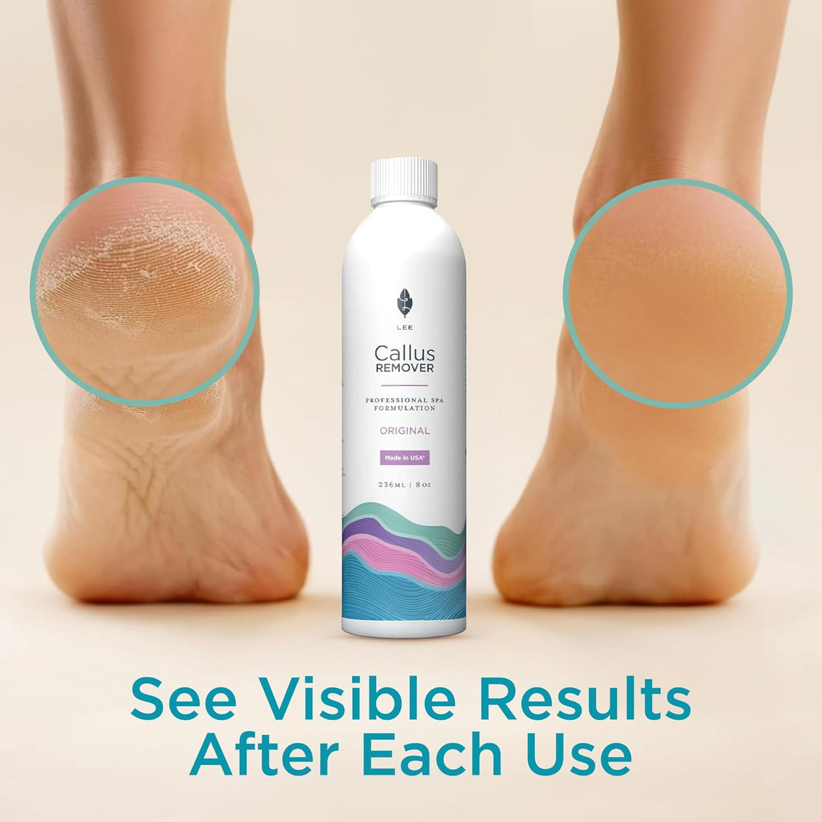 Lee Beauty Callus Remover - modo de uso